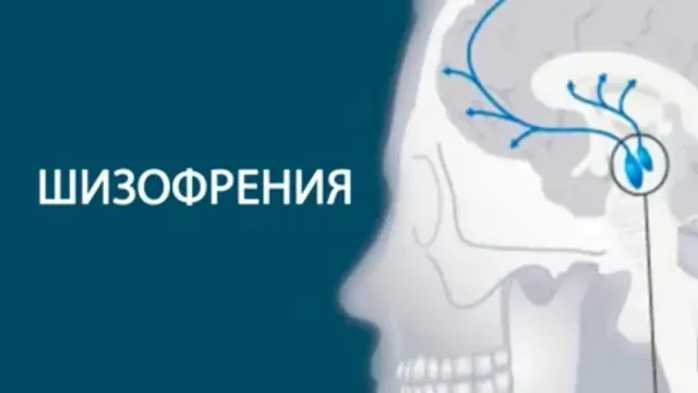 Шизофрения в Ивановской области набирает популярность