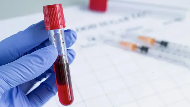 Горячая новость | Стало известно, сколько денег россияне тратят на анализы