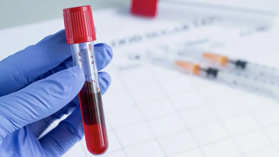 Стало известно, сколько денег россияне тратят на анализы Стало известно, сколько денег россияне тратят на анализы