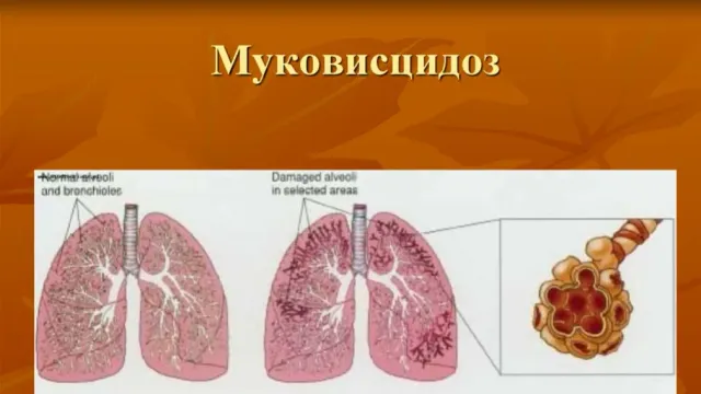 В Иванове больного ребенка будут эффективно лечить только через суд