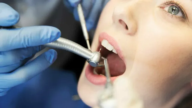 Зубы обойдутся в копейки: Вот секрет экономии!