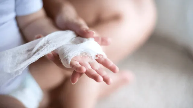 В Кинешме владелец собаки выплатил 50 тысяч после укуса ребенка